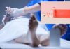 The hottest new anti-aging treatment? Cadaver skin