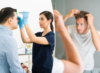 I’m a dermatologist — the top 10 things I tell balding patients