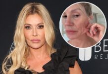 Brandi Glanville Getting Surgery to Find Out What's "Eating" Her Face